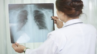 Healthcare professional holding x-ray of lungs